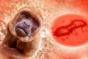 AMAZONAS e PARÁ registram casos de MPOX com números elevados.